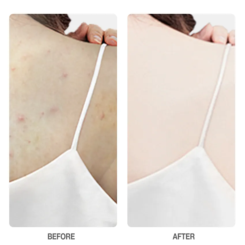 SKINEVER - SALICYLIC ACID Weightless Exfoliating Body Lotion (100ml)