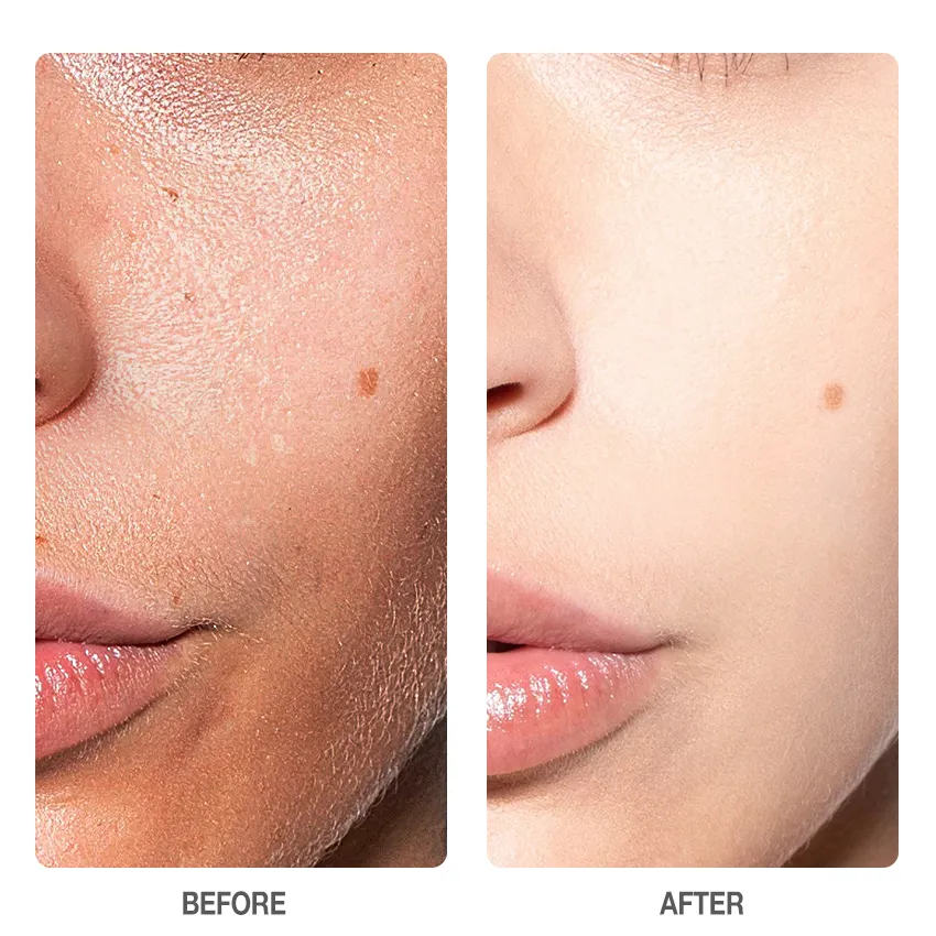 SKINEVER - SALICYLIC ACID REFRESHING SCRUB CLEANSER 75ml - Deep Cleansing Exfoliating Cleanser